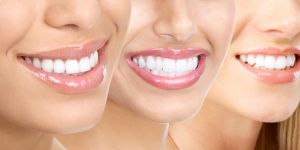 Zahnersatz, Zahnimplantate, Zirkondioxid, Für Ihr schönstes Lächeln